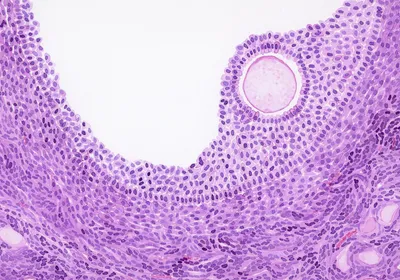 A painting capturing the H&E staining of ovarian follicle. 