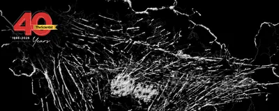 Microfilaments, mitochondria, and nuclei in fibroblast cells are shown in a super-resolution microscopy image in greyscale. The TS 40th anniversary logo is on the top left.