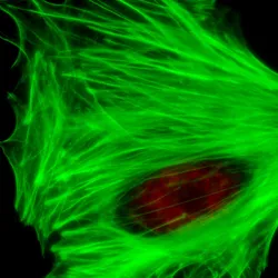 Image of a cell, signifying EGFP, the engineered fluorophore that helped image with less phototoxicity.