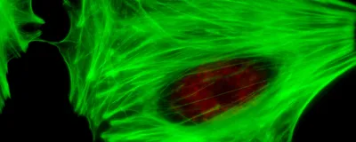 Image of a cell, signifying EGFP, the engineered fluorophore that helped image with less phototoxicity.