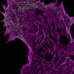 A cell with pink structures, signifying live cell super-resolution microscopy visualizing actin filaments.