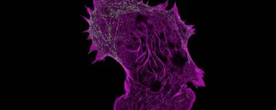 A cell with pink structures, signifying live cell super-resolution microscopy visualizing actin filaments.