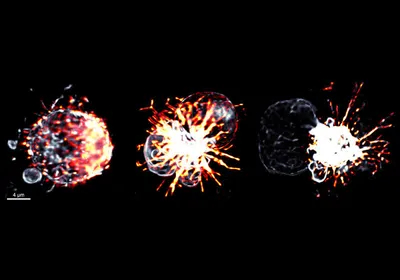 Three grey-colored circular structures with fiery red projections emerging from one side of each against a black background captured using lattice light-sheet microscopy. 