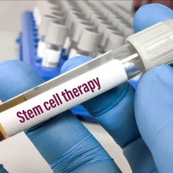Blood sample for stem cell therapy testing.