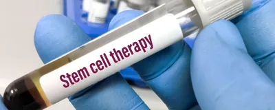 Blood sample for stem cell therapy testing.