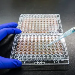 A photo of a scientist pipetting a sample into a 96-well plate.