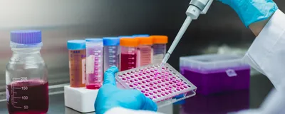 Researcher pipetting cell culture samples into a multiwell plate for in vitro drug screening