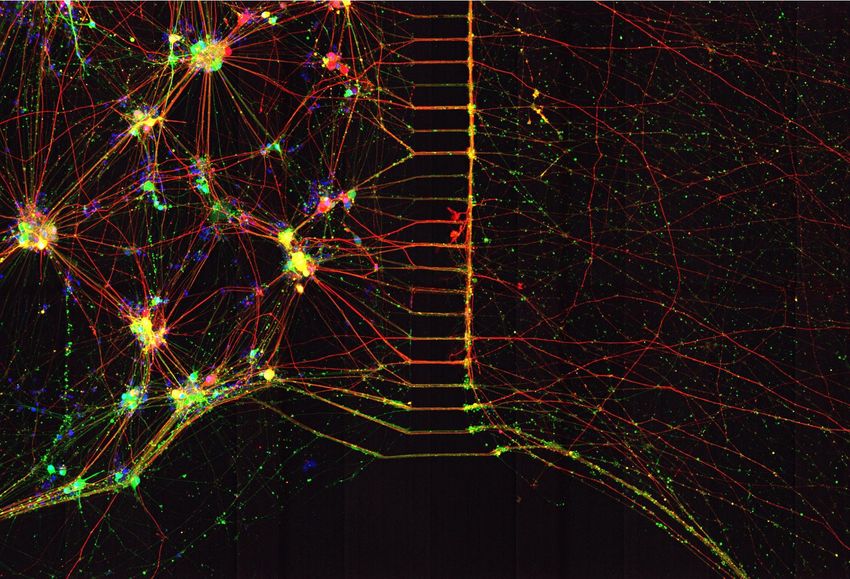 A fluorescence microscopy image of neurons expressing molecules of different colors. A fluorescence microscopy image of neurons expressing molecules of different colors.