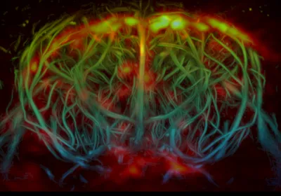 Reconstructed tomography and ultrasound image of the brain’s vasculature and glymphatic system. The blood vessels are visible as weaving strands outlining the shape of a brain, ranging from blue to green to yellow to indicate depth. The cerebrospinal fluid of the glymphatic system appears as bright orange, yellow, and red spots across the top of the brain and, with less intensity, in the middle and at the bottom of the image.