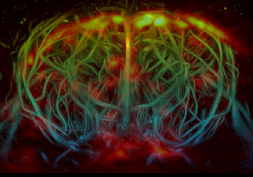 Reconstructed tomography and ultrasound image of the brain’s vasculature and glymphatic system. The blood vessels are visible as weaving strands outlining the shape of a brain, ranging from blue to green to yellow to indicate depth. The cerebrospinal fluid of the glymphatic system appears as bright orange, yellow, and red spots across the top of the brain and, with less intensity, in the middle and at the bottom of the image.