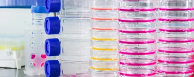 Photo of stacked cell culture flasks and dishes containing multicolored media.
