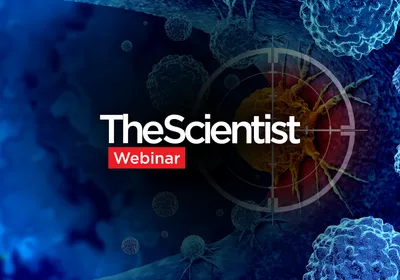 Understanding How the Tumor Microenvironment Reshapes Anti-Tumor Immunity