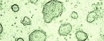 Exploring Organoids for Disease Modeling Research