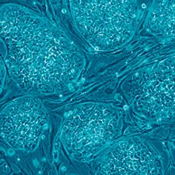 A blue-filtered microscopy image of iPSCs, signifying iPSC banking. 