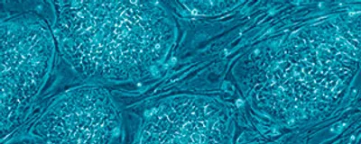 A blue-filtered microscopy image of iPSCs, signifying iPSC banking. 