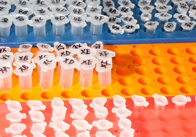 An image of microcentrifuge tubes arranged within colorful laboratory racks.
