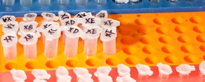An image of microcentrifuge tubes arranged within colorful laboratory racks.