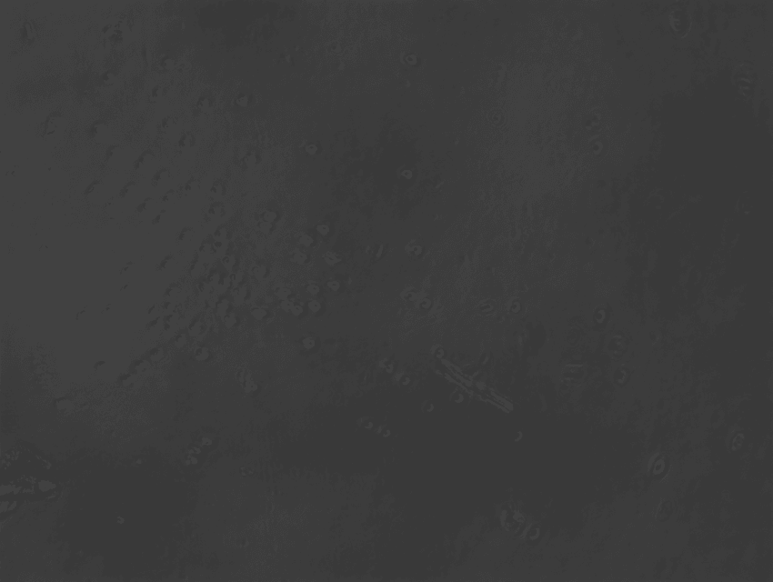 A grey-scale picture of some cells under the microscope.