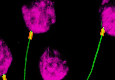 Four spermatids with axonemes looking like magenta tulips with green stems.