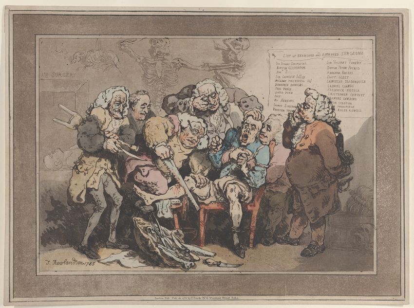 A painting depicts a patient getting his leg amputated with a saw without anesthesia.