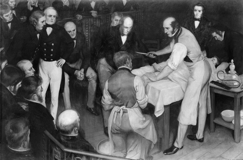 A painting shows Scottish surgeon Robert Liston performing a deadly surgery.