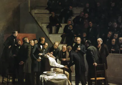 A painting depicts an operation with a patient under anesthesia as doctors surround him and other doctors watch from the operating theater.
