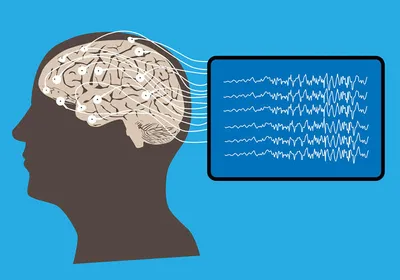 Illustration of human brain and electroencephalography, signifying brain-computer interfaces.
