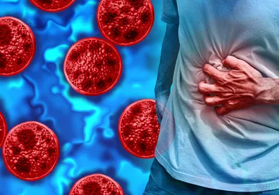 Cyclospora parasites are shown in red on the left side of the image, and a person clutching their stomach in pain is shown on the right.