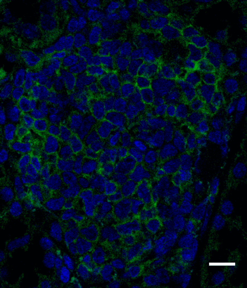 Blue and green cells against a black background.
