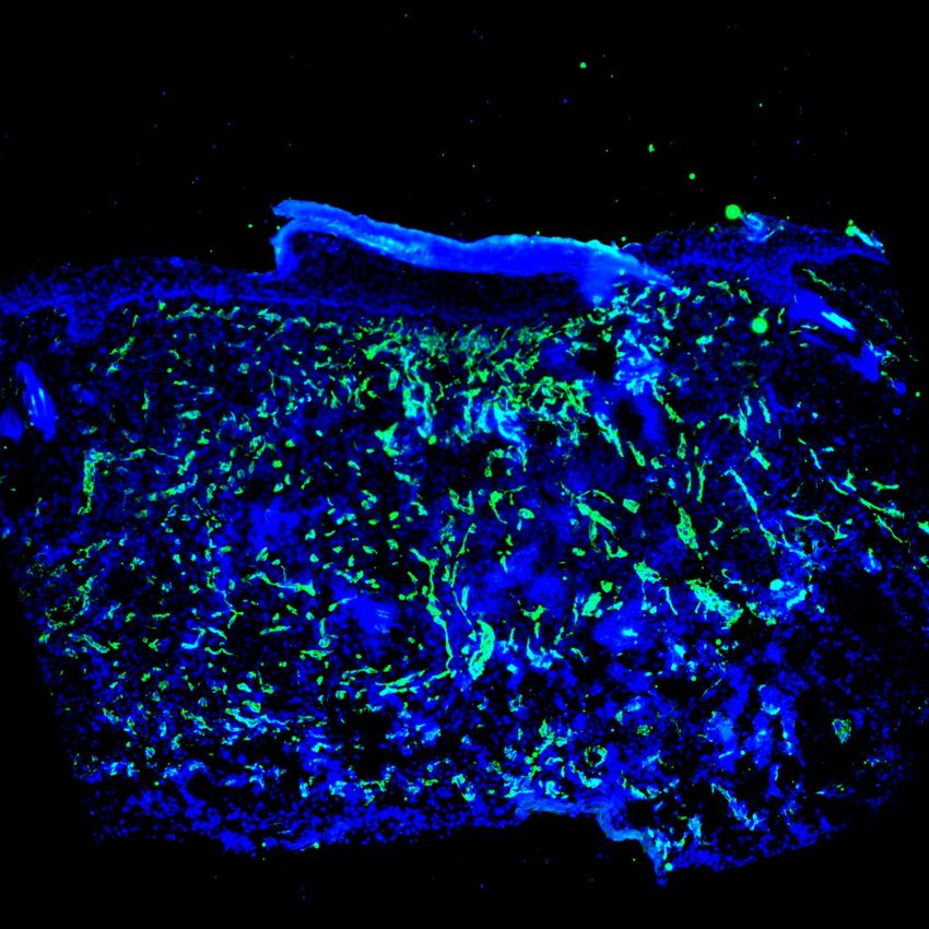 A skin sample in which endothelial cells are labelled in blue.