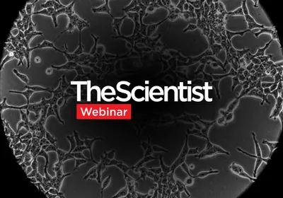Improving rAAV Production for Viral Vector Manufacturing