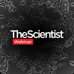 Improving rAAV Production for Viral Vector Manufacturing