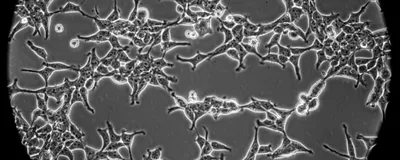 Improving rAAV Production for Viral Vector Manufacturing
