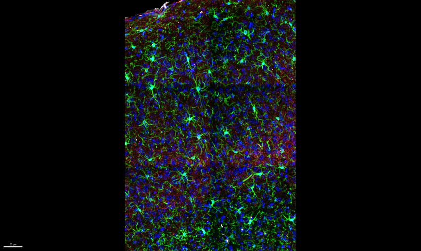 A microscopy image showing green microglia, and orange and blue cells against a black background.