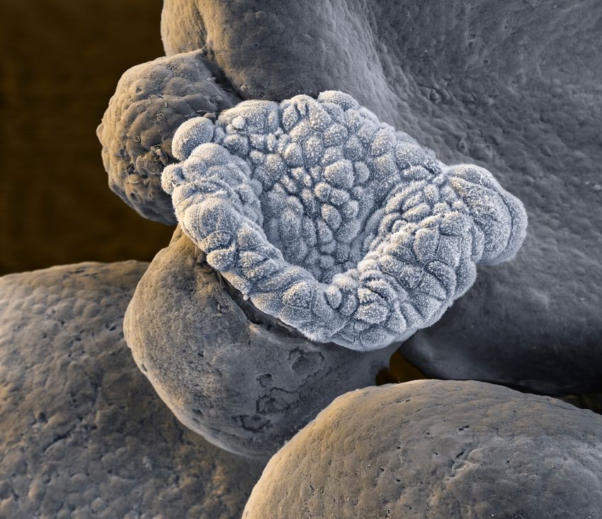 Scanning electron micrograph of a uterine organoid. The structure has the appearance of a gray piece of fleece but is actually a mass of cells.