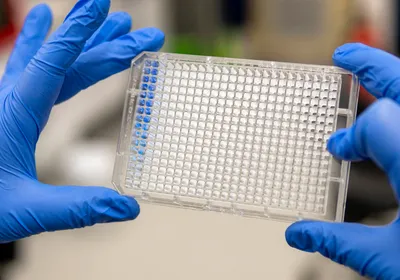 Scientist holding a clear 384-well PCR microplate in a laboratory