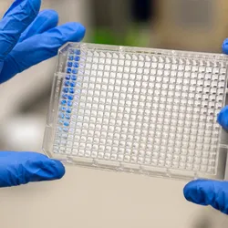 Scientist holding a clear 384-well PCR microplate in a laboratory