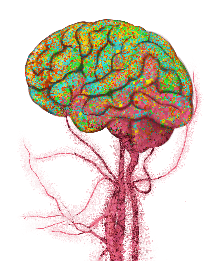 A stylized image showing peripheral cells in red taking over yellow and green-colored cells in the brain. A stylized image showing peripheral cells in red taking over yellow and green-colored cells in the brain.