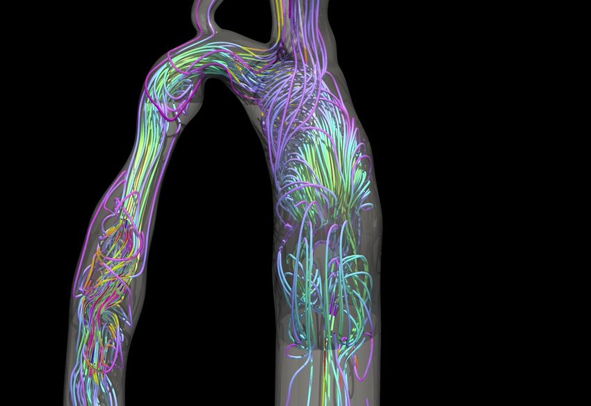 A few bright-colored lines trace grey tunnel-like structure, signifying blood flow simulations through HARVEY. A few bright-colored lines trace grey tunnel-like structure, signifying blood flow simulations through HARVEY.