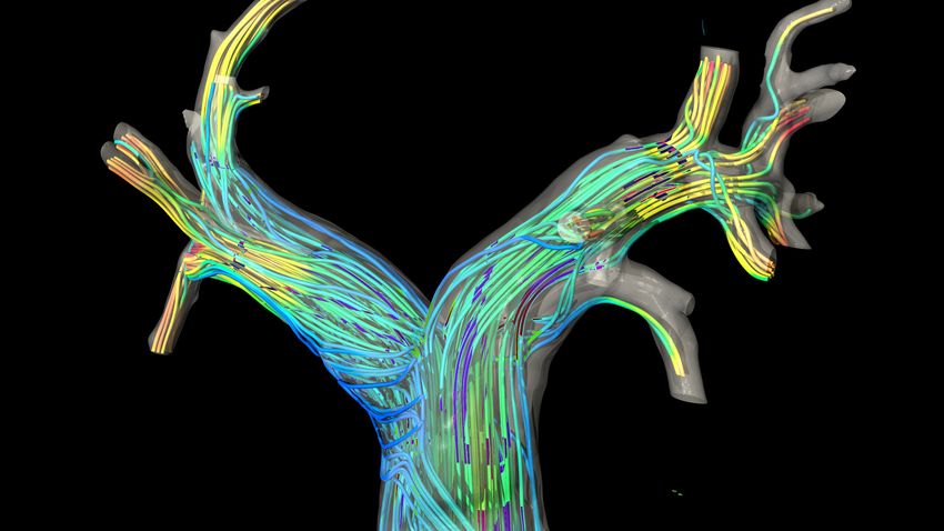 A few bright-colored lines trace grey tunnel-like structure, signifying blood flow simulations through HARVEY. A few bright-colored lines trace grey tunnel-like structure, signifying blood flow simulations through HARVEY.
