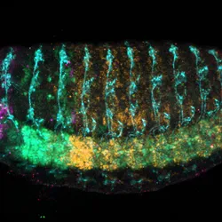 Fluorescent microscopy of a fly embryo stained with five antibodies. Along the bottom, from left to right, the following colors appear representing unique homeobox (Hox) proteins: Magenta, Green, Yellow, and Red. Vertical cyan stripes appear above this line of colors, and in the middle of the embryo behind these strips is orange staining.