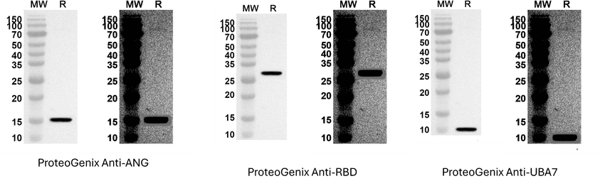 Photographs of western blot images from three different antibody in a row. The blot on the left in each panel is the original image available online and the image on the right in each panel is the same blot with the black levels raised to reveal lower intensity pixels. In the adjusted images, the same background pattern becomes visible on all three western blots despite the band being in different places. The band also appears to be the same band in all three images but moved to different locations.