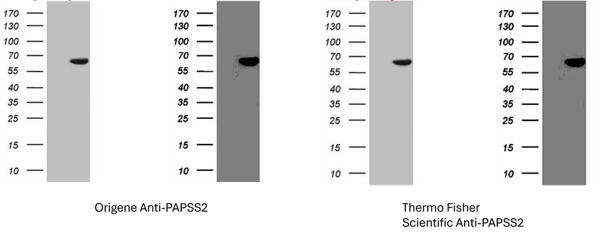Photographs of western blots from two different antibody suppliers (left and right panels) showing the same blot. The original western blot image available online is on the left side of each panel and on the right in each panel is the same blot with the black levels raised to reveal lower intensity pixels. In the adjusted images, evidence of apparent image alteration becomes visible.