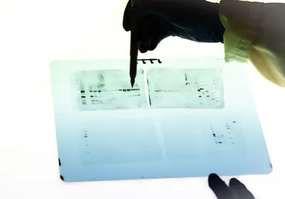 Photograph of a person’s hand holding a pen and pointing to a backlit western blot film.