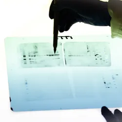 Photograph of a person’s hand holding a pen and pointing to a backlit western blot film. 