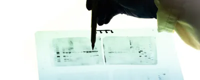 Photograph of a person’s hand holding a pen and pointing to a backlit western blot film. 
