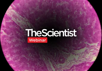 Sex-Specific Dioxin Toxicity in a Humanized AHR Model