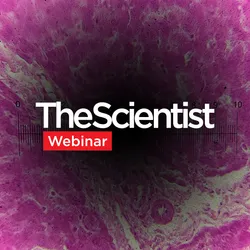 Sex-Specific Dioxin Toxicity in a Humanized AHR Model