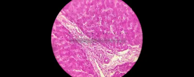 Sex-Specific Dioxin Toxicity in a Humanized AHR Model