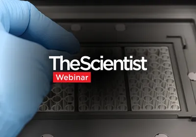 Streamlining Gene Expression Analysis From Cells to RT-qPCR